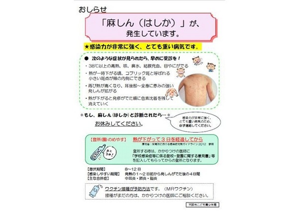 お知らせ資料「麻しん（はしか）」