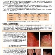 「消費者安全法第23条第１項の規定に基づく事故等原因調査報告書　毛染めによる皮膚障害」【概要】
