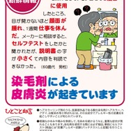 国民生活センター見守り新鮮情報第237号「染毛剤による皮膚炎が起きています」