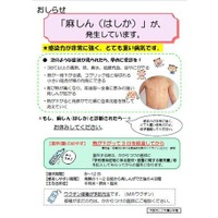 インフルエンザや風しん…登園目安は？感染症18種の予防対策資料公開 画像